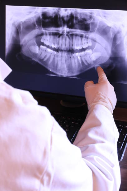 Tooth Infection Emergency Dentist in WY